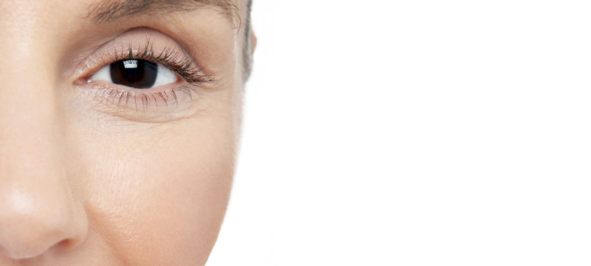 Atópiás bőr Igaz -  hamis